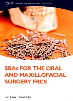 SBAs for the Oral and Maxillofacial Surgery FRCS Supply